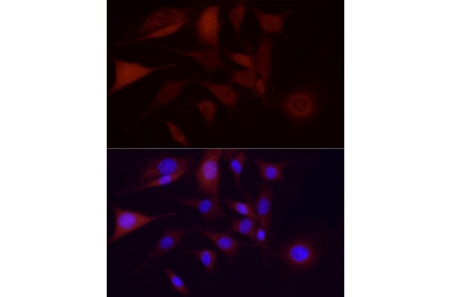 Immunofluorescence - Anti-CDK1 Antibody [ARC50607] (A305462) - Antibodies.com