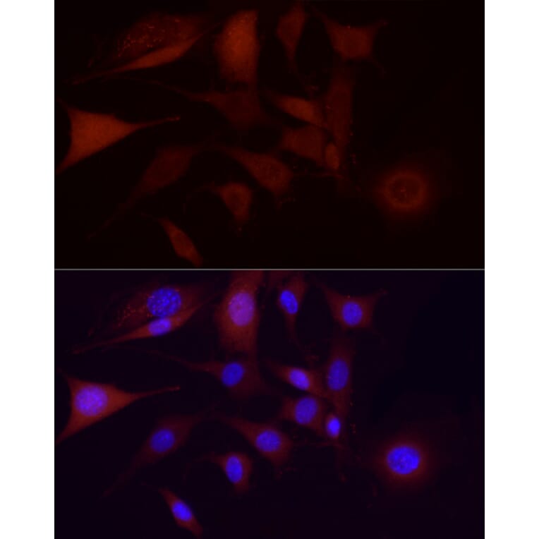 Immunofluorescence - Anti-CDK1 Antibody [ARC50607] (A305462) - Antibodies.com