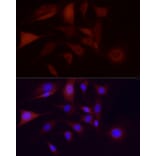 Immunofluorescence - Anti-CDK1 Antibody [ARC50607] (A305462) - Antibodies.com