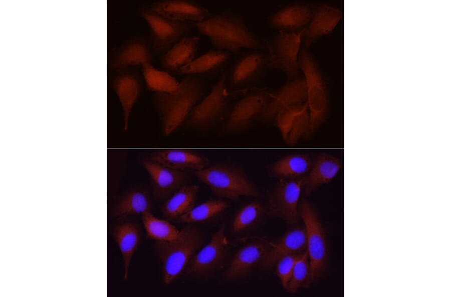 Immunofluorescence - Anti-CDK1 Antibody [ARC50607] (A305462) - Antibodies.com