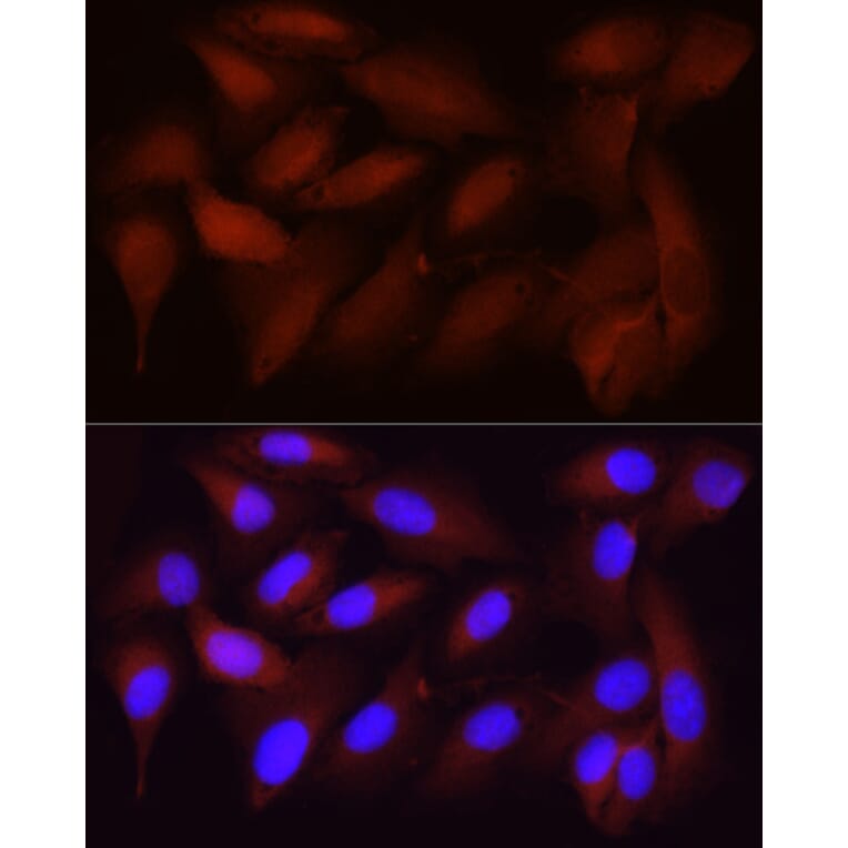 Immunofluorescence - Anti-CDK1 Antibody [ARC50607] (A305462) - Antibodies.com