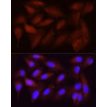 Immunofluorescence - Anti-CDK1 Antibody [ARC50607] (A305462) - Antibodies.com