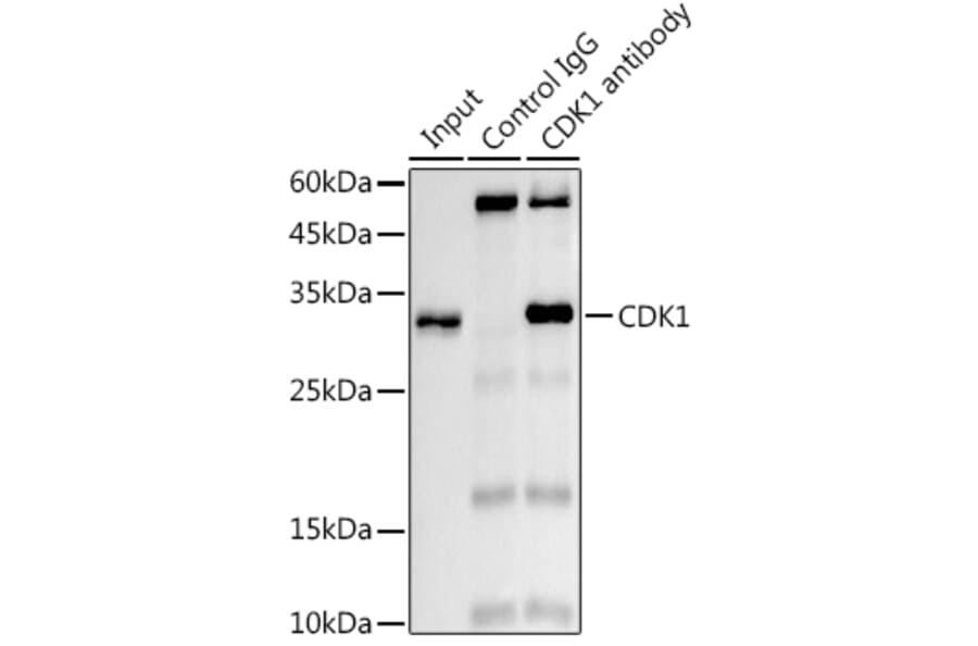 Western Blot - Anti-CDK1 Antibody [ARC50607] (A305462) - Antibodies.com