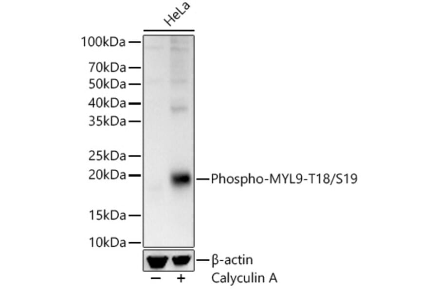 Western Blot - Anti-MYL9 (phospho Thr18 + Ser19) Antibody (A305466) - Antibodies.com