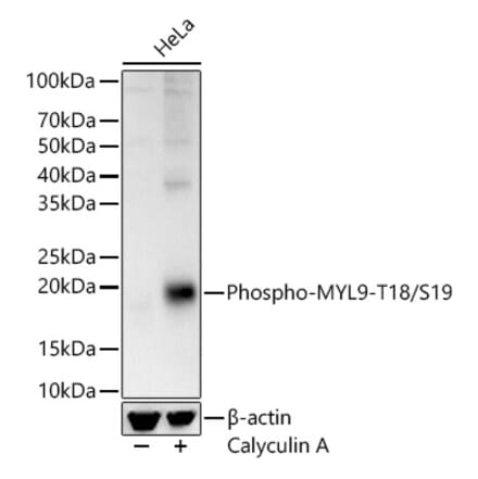 Western Blot - Anti-MYL9 (phospho Thr18 + Ser19) Antibody (A305466) - Antibodies.com