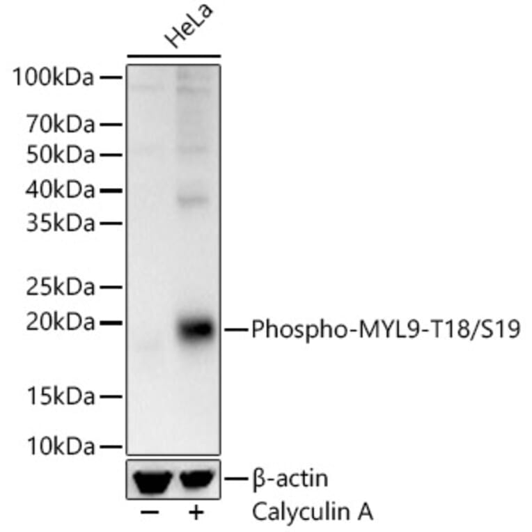 Western Blot - Anti-MYL9 (phospho Thr18 + Ser19) Antibody (A305466) - Antibodies.com