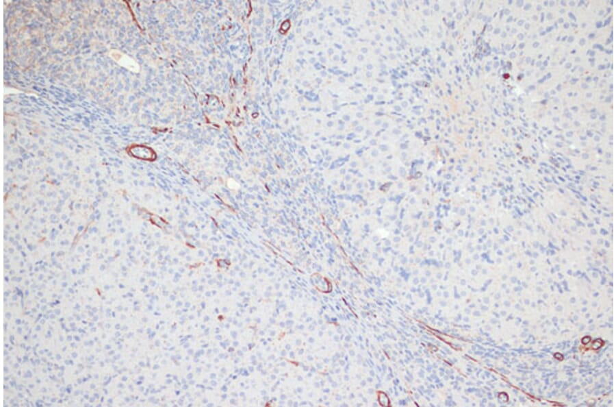 Immunohistochemistry - Anti-MYL9 (phospho Thr18 + Ser19) Antibody (A305466) - Antibodies.com