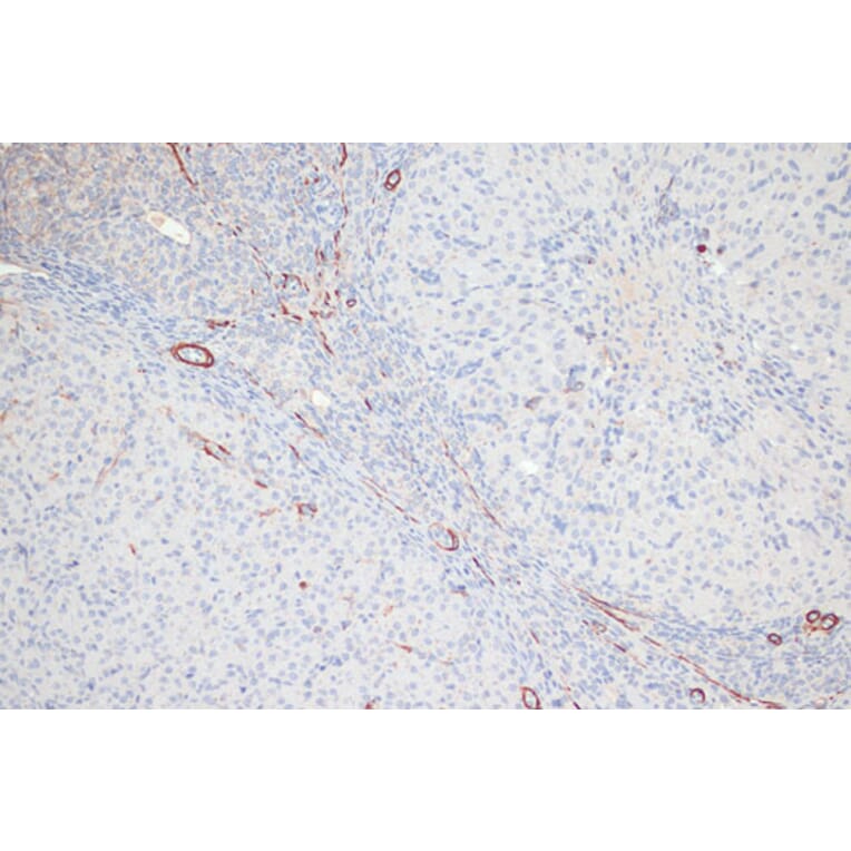 Immunohistochemistry - Anti-MYL9 (phospho Thr18 + Ser19) Antibody (A305466) - Antibodies.com