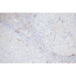 Immunohistochemistry - Anti-MYL9 (phospho Thr18 + Ser19) Antibody (A305466) - Antibodies.com