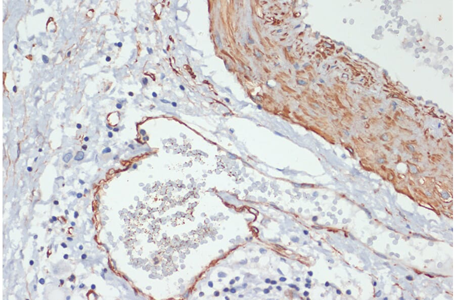 Immunohistochemistry - Anti-MYL9 (phospho Thr18 + Ser19) Antibody (A305466) - Antibodies.com