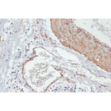 Immunohistochemistry - Anti-MYL9 (phospho Thr18 + Ser19) Antibody (A305466) - Antibodies.com