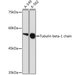 Western Blot - Anti-beta I Tubulin Antibody [ARC2484] (A305467) - Antibodies.com