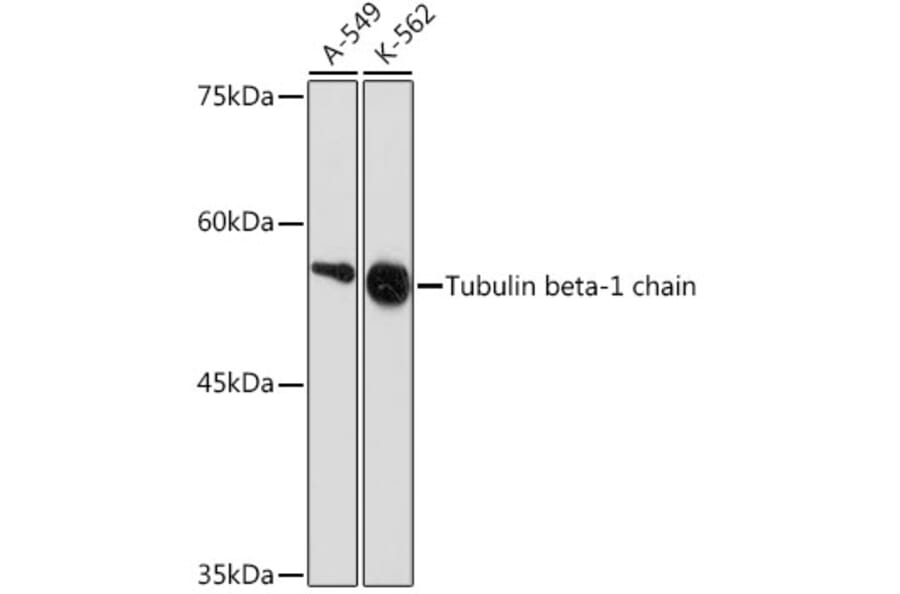 Western Blot - Anti-beta I Tubulin Antibody [ARC2484] (A305467) - Antibodies.com