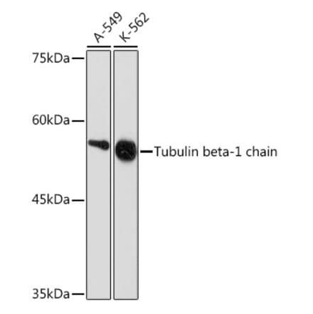 Western Blot - Anti-beta I Tubulin Antibody [ARC2484] (A305467) - Antibodies.com
