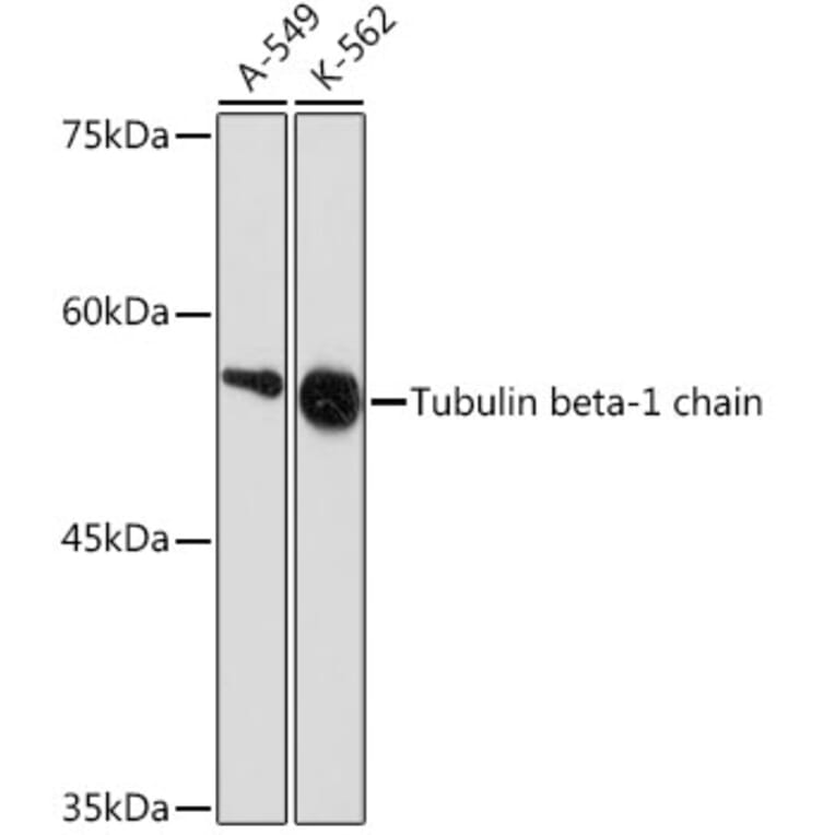 Western Blot - Anti-beta I Tubulin Antibody [ARC2484] (A305467) - Antibodies.com