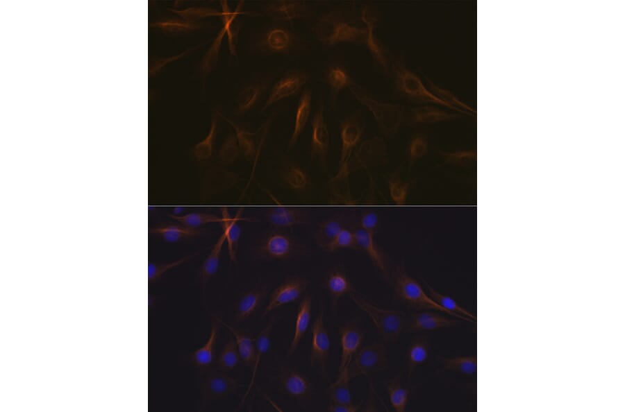 Immunofluorescence - Anti-beta I Tubulin Antibody [ARC2484] (A305467) - Antibodies.com