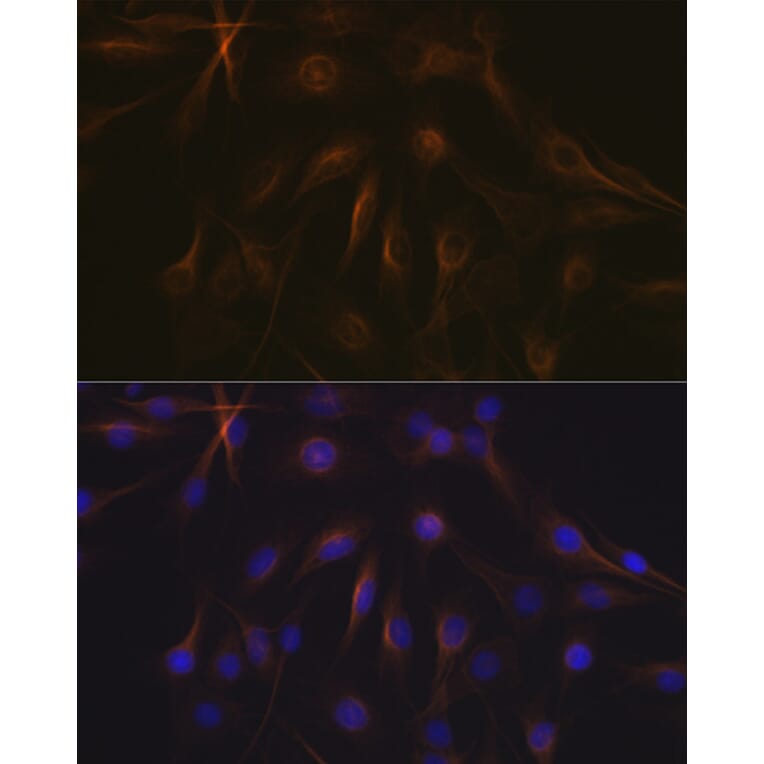 Immunofluorescence - Anti-beta I Tubulin Antibody [ARC2484] (A305467) - Antibodies.com