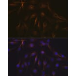 Immunofluorescence - Anti-beta I Tubulin Antibody [ARC2484] (A305467) - Antibodies.com