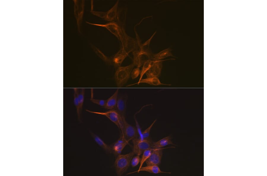 Immunofluorescence - Anti-beta I Tubulin Antibody [ARC2484] (A305467) - Antibodies.com