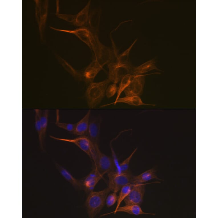 Immunofluorescence - Anti-beta I Tubulin Antibody [ARC2484] (A305467) - Antibodies.com