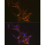 Immunofluorescence - Anti-beta I Tubulin Antibody [ARC2484] (A305467) - Antibodies.com