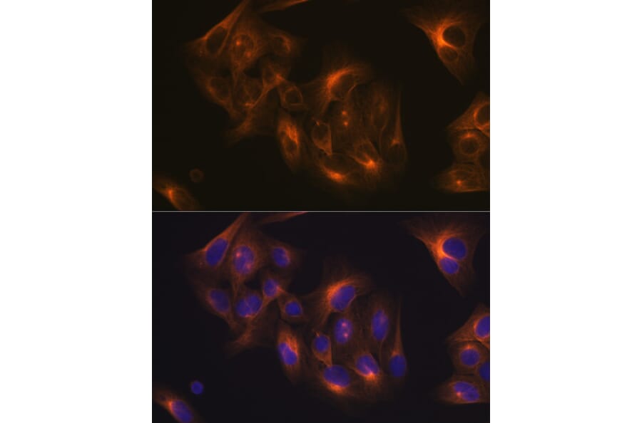 Immunofluorescence - Anti-beta I Tubulin Antibody [ARC2484] (A305467) - Antibodies.com