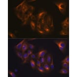 Immunofluorescence - Anti-beta I Tubulin Antibody [ARC2484] (A305467) - Antibodies.com