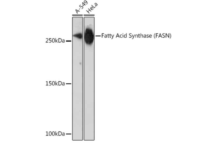 Western Blot - Anti-Fatty Acid Synthase Antibody [ARC0377] (A305468) - Antibodies.com