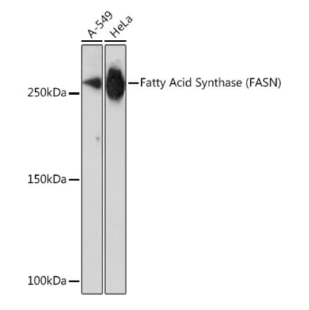 Western Blot - Anti-Fatty Acid Synthase Antibody [ARC0377] (A305468) - Antibodies.com