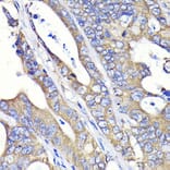 Immunohistochemistry - Anti-Fatty Acid Synthase Antibody [ARC0377] (A305468) - Antibodies.com