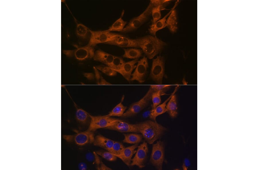 Immunofluorescence - Anti-Fatty Acid Synthase Antibody [ARC0377] (A305468) - Antibodies.com