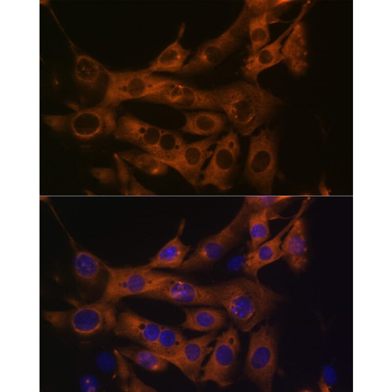 Immunofluorescence - Anti-Fatty Acid Synthase Antibody [ARC0377] (A305468) - Antibodies.com