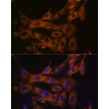 Immunofluorescence - Anti-Fatty Acid Synthase Antibody [ARC0377] (A305468) - Antibodies.com