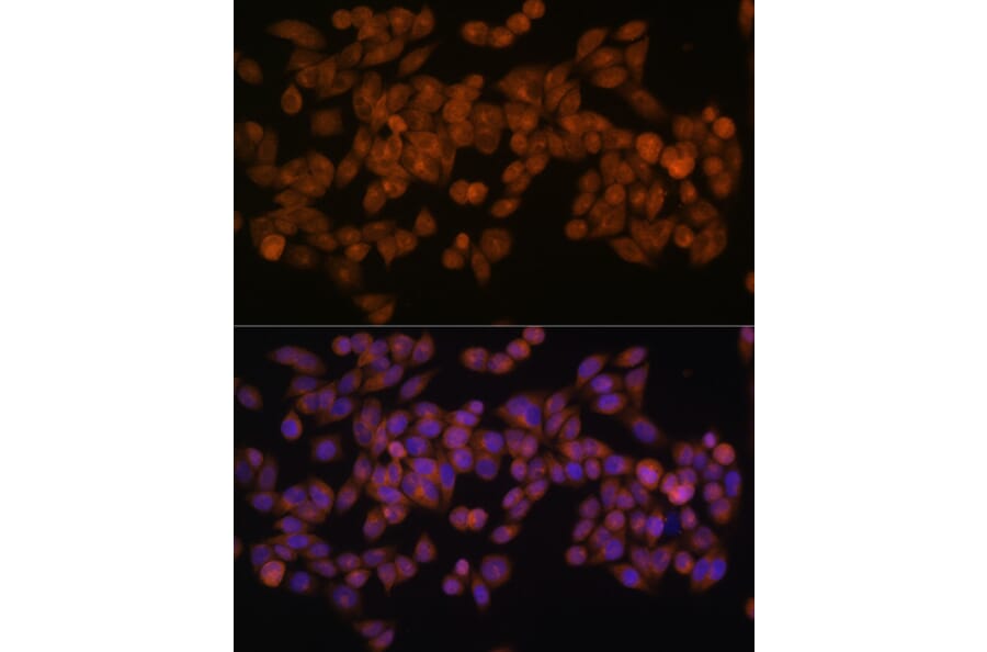 Immunofluorescence - Anti-Fatty Acid Synthase Antibody [ARC0377] (A305468) - Antibodies.com