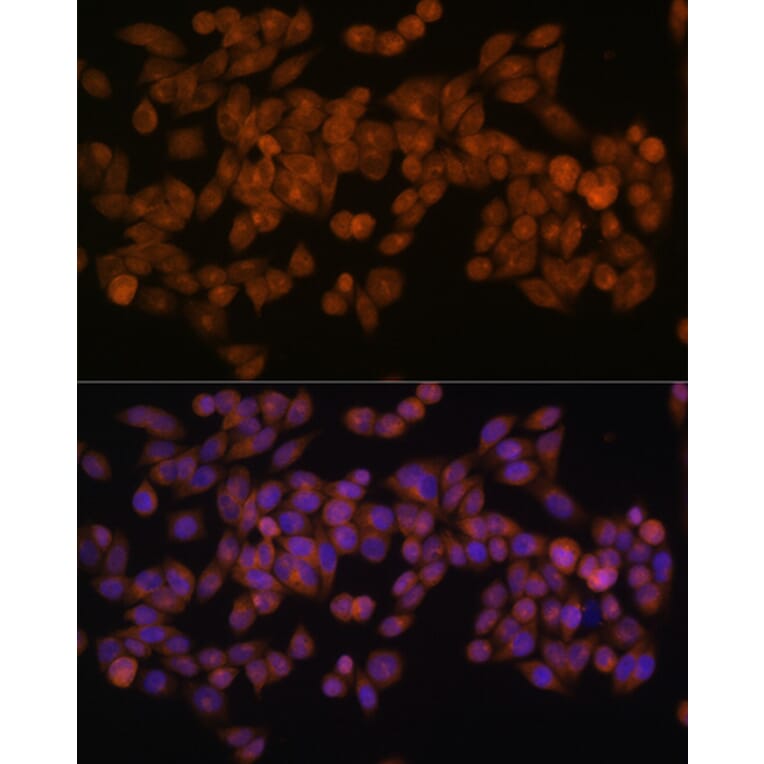 Immunofluorescence - Anti-Fatty Acid Synthase Antibody [ARC0377] (A305468) - Antibodies.com