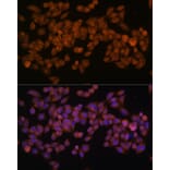 Immunofluorescence - Anti-Fatty Acid Synthase Antibody [ARC0377] (A305468) - Antibodies.com