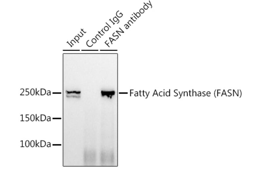 Western Blot - Anti-Fatty Acid Synthase Antibody [ARC0377] (A305468) - Antibodies.com