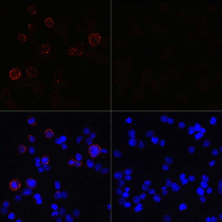 Immunofluorescence - Anti-SARS-CoV2 NSP13 Antibody (A305469) - Antibodies.com