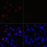 Immunofluorescence - Anti-SARS-CoV2 NSP13 Antibody (A305469) - Antibodies.com