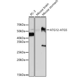 Western Blot - Anti-ATG12 Antibody [ARC0089] (A305470) - Antibodies.com