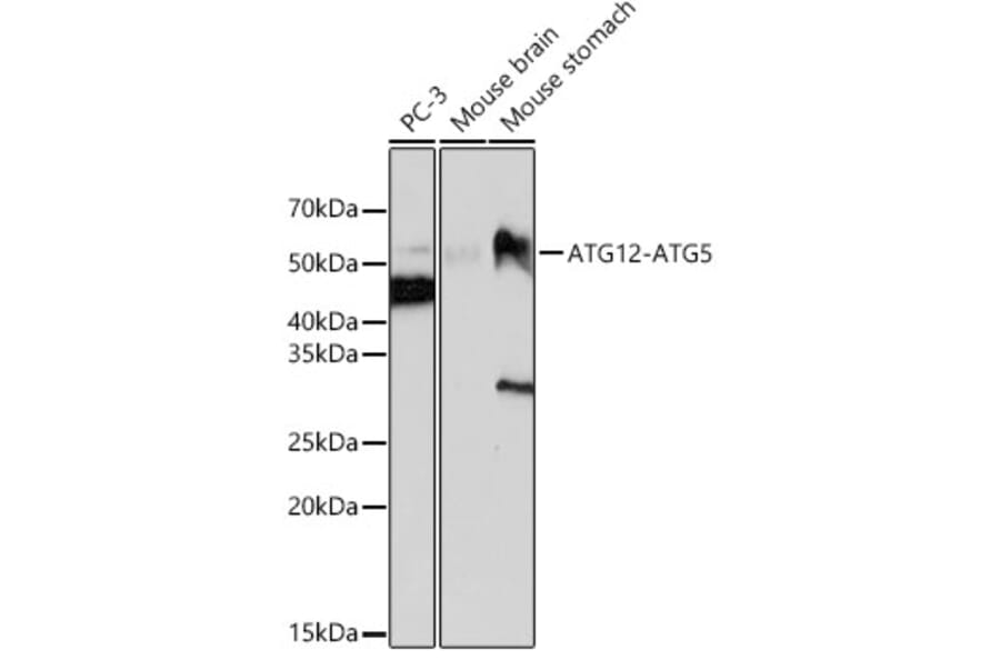 Western Blot - Anti-ATG12 Antibody [ARC0089] (A305470) - Antibodies.com