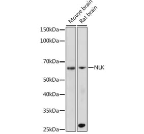 Western Blot - Anti-NLK Antibody [ARC2441] (A305472) - Antibodies.com