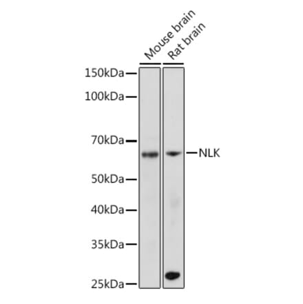 Western Blot - Anti-NLK Antibody [ARC2441] (A305472) - Antibodies.com