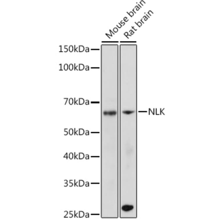 Western Blot - Anti-NLK Antibody [ARC2441] (A305472) - Antibodies.com