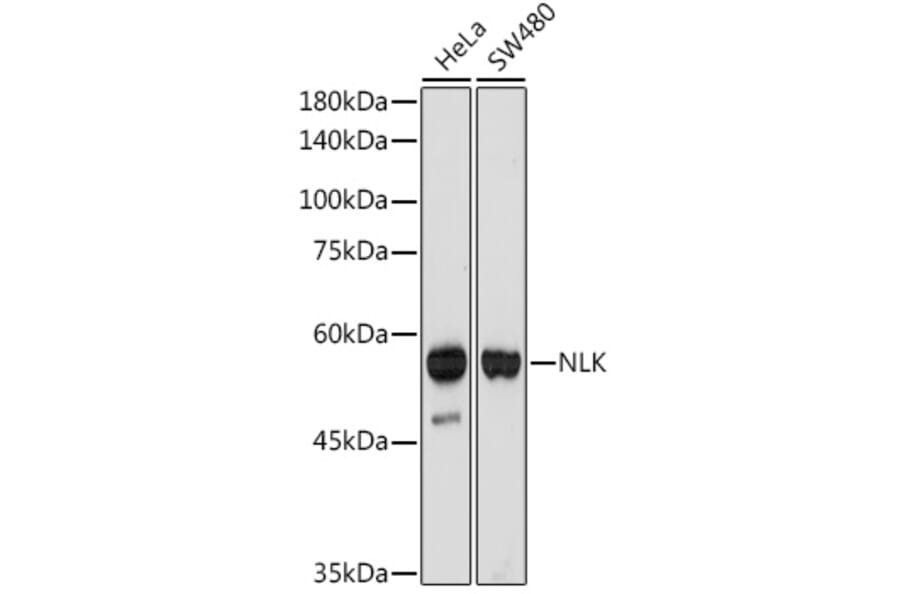 Western Blot - Anti-NLK Antibody [ARC2441] (A305472) - Antibodies.com