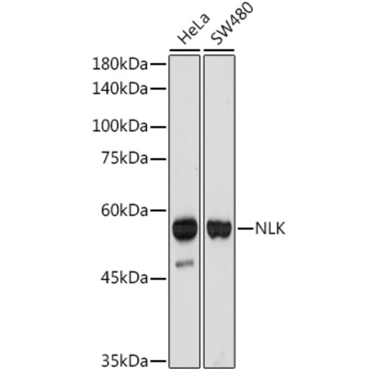 Western Blot - Anti-NLK Antibody [ARC2441] (A305472) - Antibodies.com