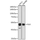 Western Blot - Anti-NLK Antibody [ARC2441] (A305472) - Antibodies.com