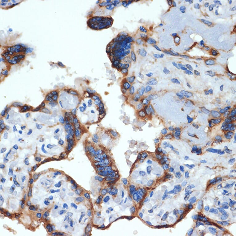 Immunohistochemistry - Anti-NLK Antibody [ARC2441] (A305472) - Antibodies.com