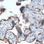 Immunohistochemistry - Anti-NLK Antibody [ARC2441] (A305472) - Antibodies.com