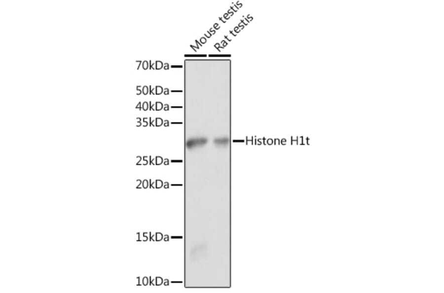 Western Blot - Anti-Histone H1 Antibody (A305473) - Antibodies.com